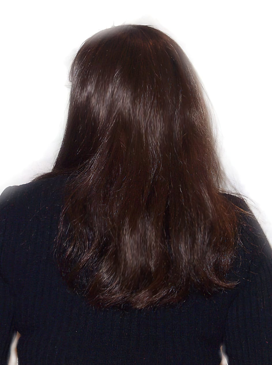 After Picture - Trichotillomania Success - Now Pull-Free